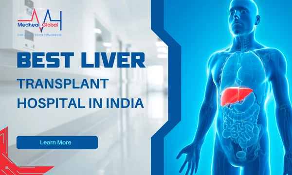 Liver Transplant Hospitals In India