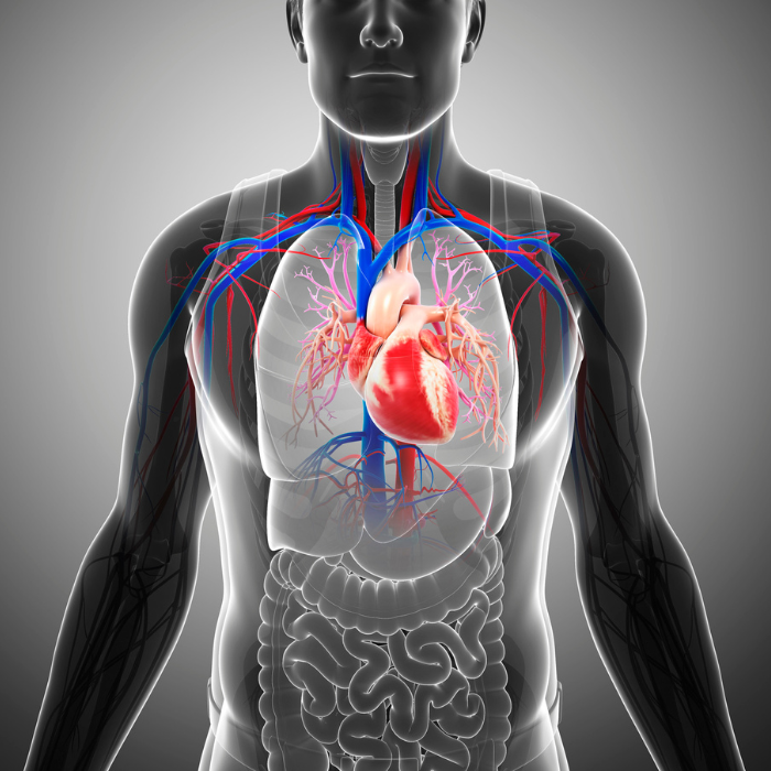 Ventricular Septal Defect