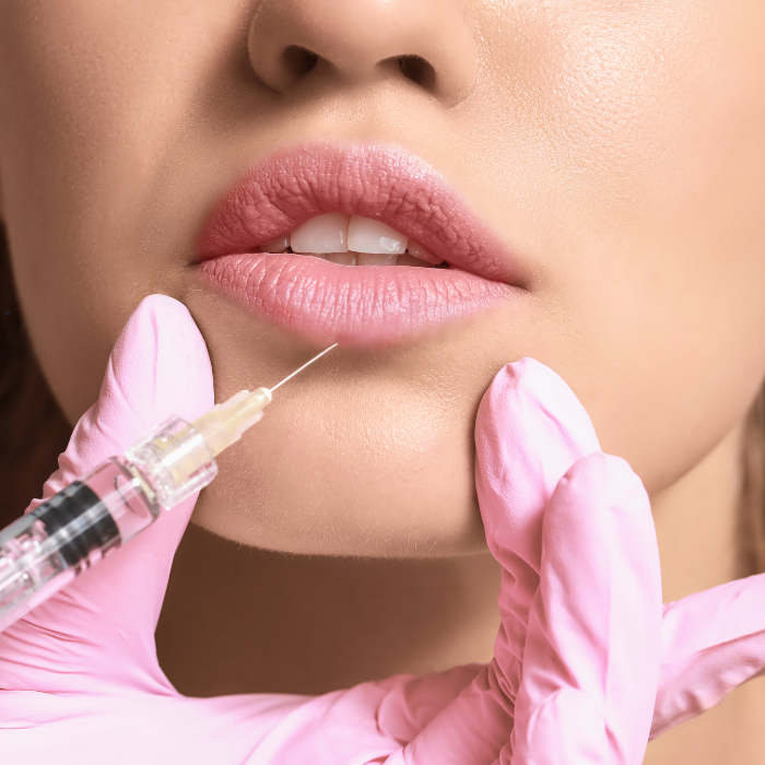 Lip Augmentation Surgery