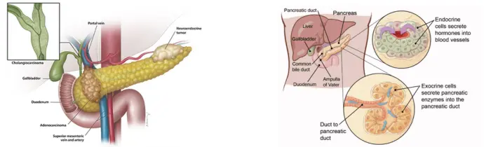 Pancreatic Cancer Treatment in India