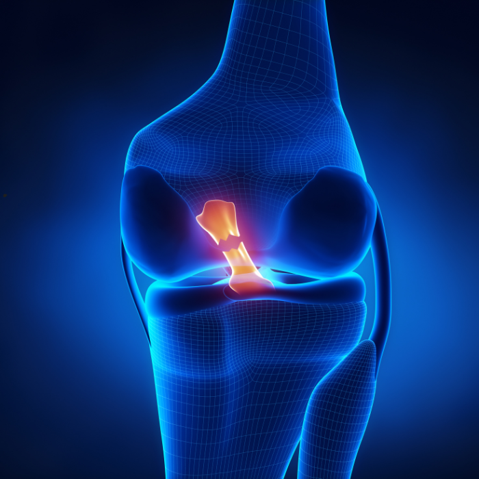 Anterior Cruciate Ligament