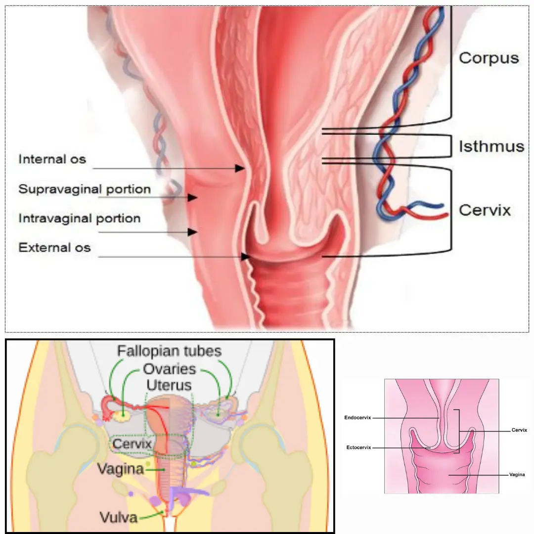 Cervical Cancer Treatment in India