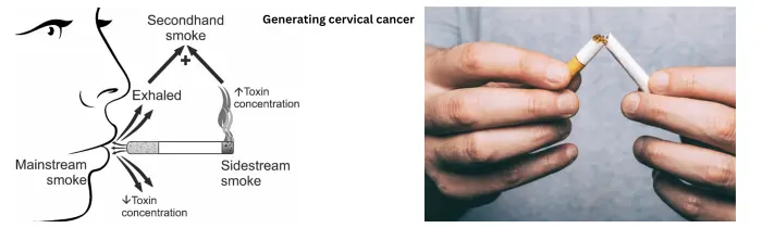 Best Cervical Cancer Treatment in India