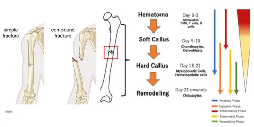 Best Bone Fracture Treatment India