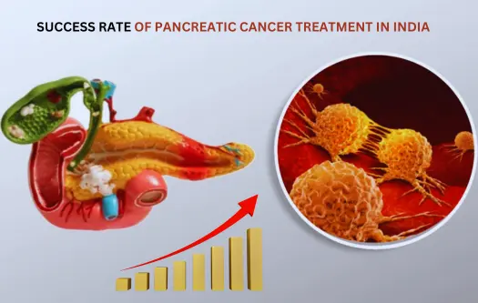 Pancreatic Cancer Treatment in India