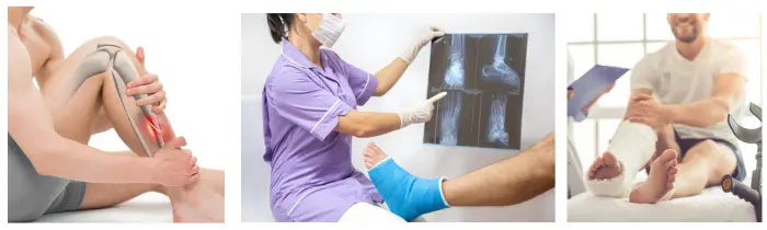 Best Bone Fracture Treatment In India